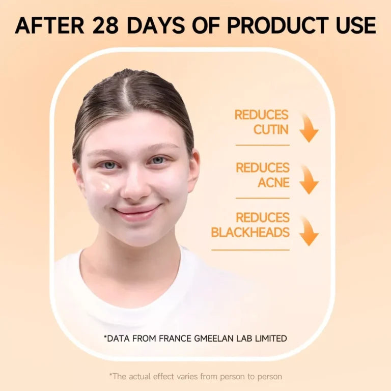 30% Off Orange Exfoliating Whitening Gel